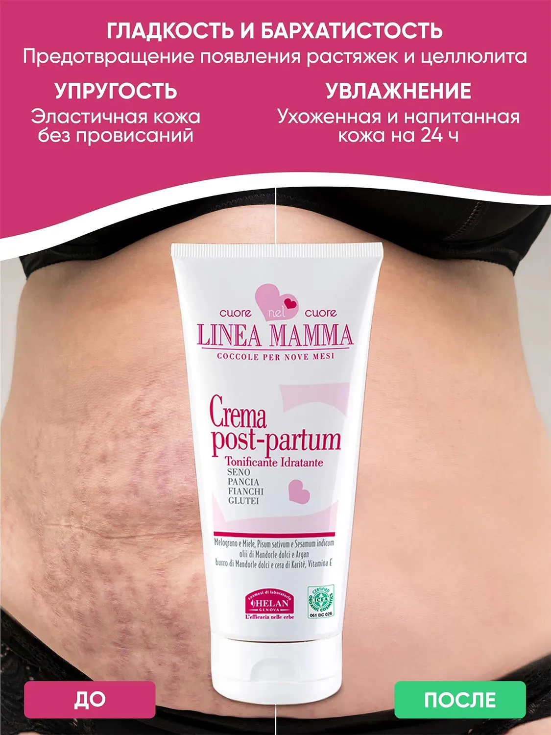 Крем HELAN Linea Mamma для восстановления фигуры после родов 150 мл 138PP-RU